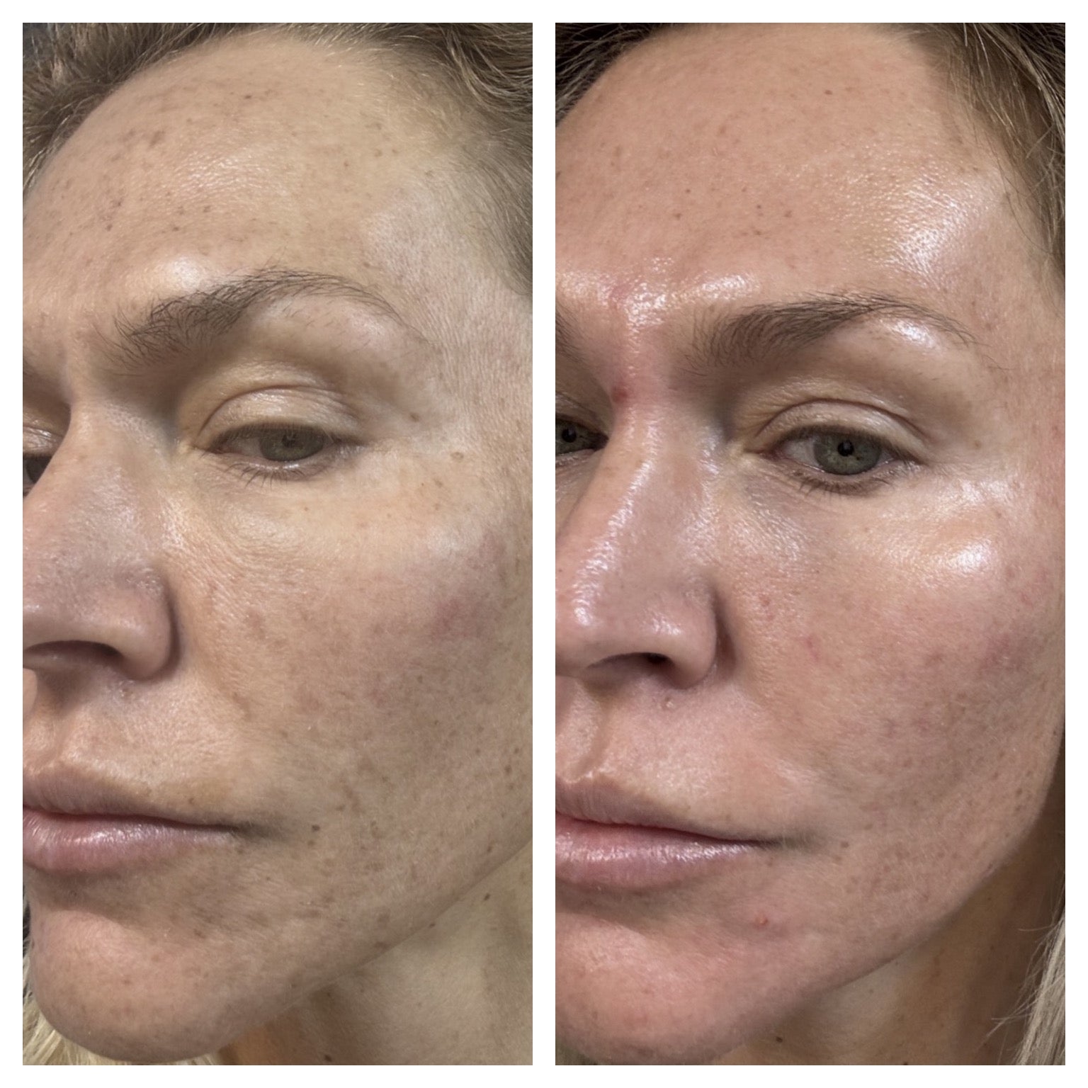 THE RADIANCE TRANSFORMATION PROTOCOL